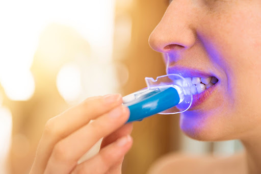 Do DIY Teeth Whitening Methods Actually Work?