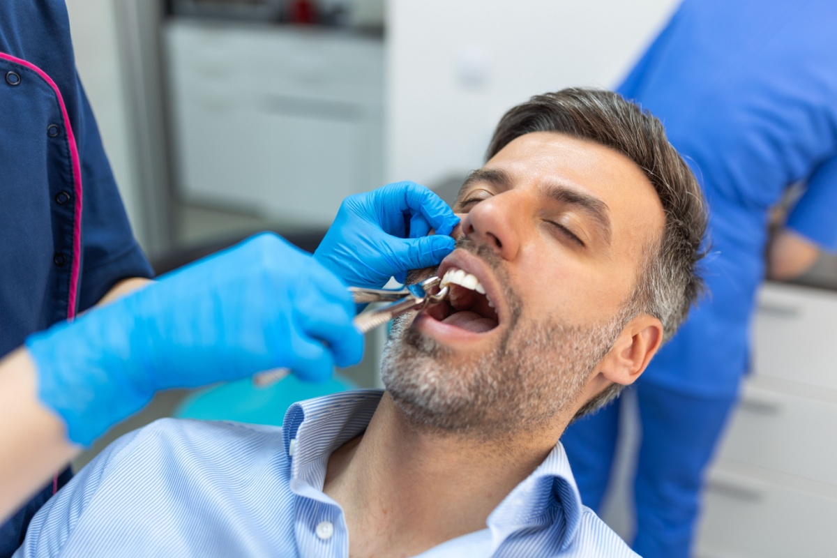 Five Common Reasons for Tooth Extraction